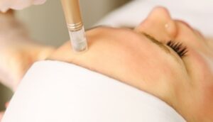 Beautician cosmetologist doing procedure fractional microneedle mesotherapy with Dermapen.